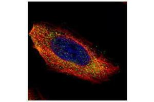 ICC/IF Image Confocal immunofluorescence analysis (Olympus FV10i) of paraformaldehyde-fixed HeLa, using MEK1, antibody (Green) at 1:200 dilution.