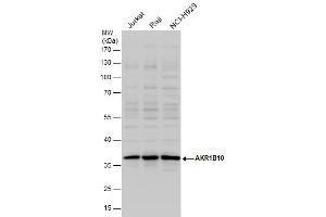 WB Image AKR1B10 antibody detects AKR1B10 protein by western blot analysis. (AKR1B10 anticorps)