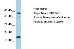 Western Blotting (WB) image for anti-Cyclin-Dependent Kinase 2 Associated Protein 1 (CDK2AP1) (C-Term) antibody (ABIN2789771) (CDK2AP1 anticorps  (C-Term))