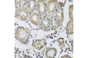 Immunohistochemistry of paraffin-embedded human gastric using MRPS22 antibody at dilution of 1:100 (x40 lens). (MRPS22 anticorps)