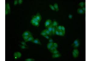 Immunofluorescence staining of HepG2 cells with ABIN7156735 at 1:133, counter-stained with DAPI. (IL1RAPL1 anticorps  (AA 564-679))