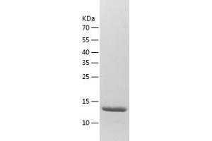 Western Blotting (WB) image for Smad Nuclear Interacting Protein 1 (SNIP1) (AA 258-396) protein (His-IF2DI Tag) (ABIN7125120)
