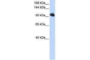 WB Suggested Anti-SFRS8 Antibody Titration:  0. (SFRS8 anticorps  (N-Term))