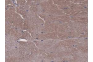 DAB staining on IHC-P; Samples: Mouse Skeletal muscle Tissue (FPGS anticorps  (AA 210-439))