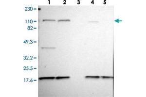 Western blot analysis of Lane 1: RT-4, Lane 2: U-251 MG, Lane 3: Human Plasma, Lane 4: Liver, Lane 5: Tonsil with KIF5A polyclonal antibody . (KIF5A anticorps)