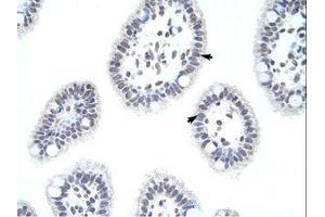 Image no. 1 for anti-Heterogeneous Nuclear Ribonucleoprotein D (HNRNPD) (AA 61-110) antibody (ABIN203267)