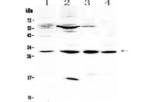 Western blot analysis of VEGFB using anti-VEGFB antibody . (VEGFB anticorps  (AA 25-138))