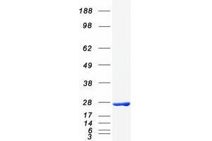 Validation with Western Blot