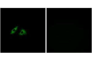 Immunofluorescence analysis of HeLa cells, using GPR152 Antibody. (GPR152 anticorps  (AA 301-350))