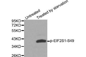 Western blot analysis of extracts from HeLa cells, using phospho-EIF2S1-S49 antibody (ABIN2987986). (EIF2S1 anticorps  (pSer49))