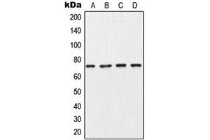 Western blot analysis of Collagen 8 alpha 1 expression in MDA-MB453 (A), A549 (B), SP2/0 (C), PC12 (D) whole cell lysates. (COL8A1 anticorps  (Center))