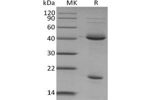 Western Blotting (WB) image for Interleukin 23 (IL23) protein (ABIN7320867) (IL23 Protéine)