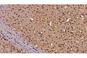 Detection of CBX3 in Mouse Cerebrum Tissue using Polyclonal Antibody to Chromobox Homolog 3 (CBX3)