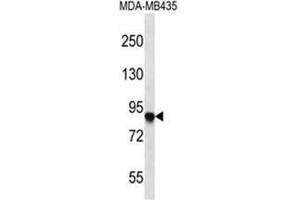 AFAP1 Antibody (C-term) western blot analysis in MDA-MB435 cell line lysates (35 µg/lane).