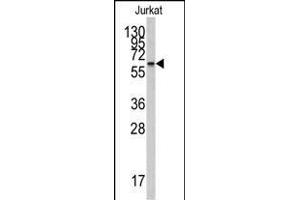 Western blot analysis of anti-CYP26A1 Antibody (Center) (ABIN389234 and ABIN2837922) in Jurkat cell line lysates (35 μg/lane). (CYP26A1 anticorps  (AA 118-147))