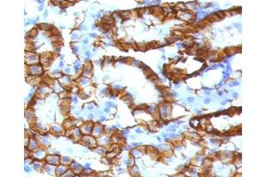 IHC testing of FFPE mouse kidney tissue with recombinant Cadherin 16 antibody (clone KSCP2-2R). (Cadherin-16 anticorps)