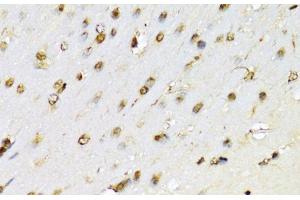 Immunohistochemistry of paraffin-embedded Mouse brain using RUNX1 Polyclonal Antibody at dilution of 1:100 (40x lens). (RUNX1 anticorps)