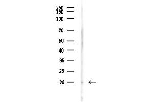 Western blot analysis of lysates from Rat brain, using CPLX1 Antibody at 1/1000 dilution.