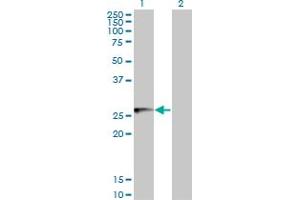 Western Blot analysis of HLA-DMB expression in transfected 293T cell line by HLA-DMB monoclonal antibody (M06), clone 5G11.