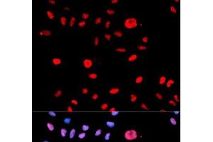 Immunofluorescence analysis of U2OS cells using Phospho-MDM2(S166) Polyclonal Antibody