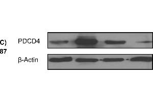 Western blotting analysis demonstrating over-expression or knock-down of PDCD4 using PDCD4 plasmid or PDCD4 targeted siRNA, respectively, versus control plasmids (PCMV6, siRNA ctrl) in the UT-SCC cell lines (A) 24A, (B) 74A, and (C) 87.