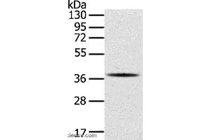 Western blot analysis of A375 cell, using SPARC Polyclonal Antibody at dilution of 1:400 (SPARC anticorps)