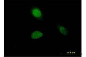 Immunofluorescence of purified MaxPab antibody to HIST1H1A on HeLa cell. (Histone H1.1 anticorps  (AA 1-215))