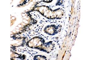 IHC-P: PLK2 antibody testing of rat intestine tissue (PLK2 anticorps  (C-Term))