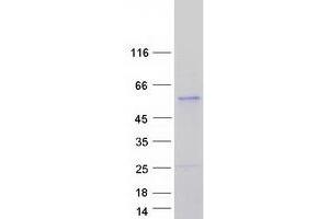 Validation with Western Blot