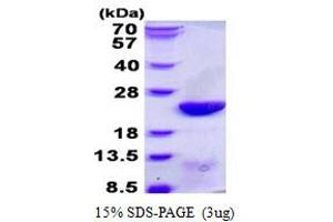 Image no. 1 for Ubiquitin-Conjugating Enzyme E2C (UBE2C) protein (His tag) (ABIN1098371)
