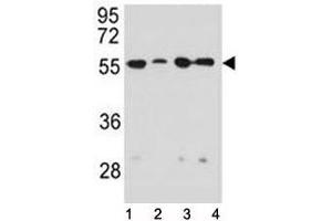 Vimentin antibody western blot analysis in 1) HeLa, 2) U251, 3) A549, and 4) MDA-MB231 lysate (Vimentin anticorps)