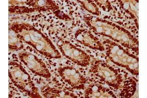 IHC image of nsucHU diluted at 1:20 and staining in paraffin-embedded human small intestine tissue performed on a Leica BondTM system. (HIST1H3A anticorps  (AA 120-132))