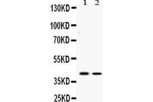 Western blot analysis of ATF4 expression in U2OS whole cell lysates ( Lane 1) and SW620 whole cell lysates ( Lane 2).