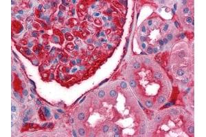 Immunohistochemical analysis of paraffin-embedded human Kidney tissues using anti-A1BG antibody (A1BG anticorps)