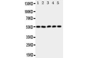 Western Blotting (WB) image for anti-Hyaluronidase-2 (HYAL2) (AA 142-157), (C-Term) antibody (ABIN3043041) (HYAL2 anticorps  (C-Term))