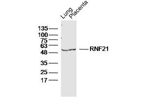 Lane 1: Mouse Lung lysates Lane 2: Mouse Placenta lysates probed with RNF21 Polyclonal Antibody, Unconjugated  at 1:300 dilution and 4˚C overnight incubation.