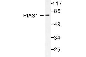 Image no. 1 for anti-Protein Inhibitor of Activated STAT, 1 (PIAS1) antibody (ABIN271951) (PIAS1 anticorps)