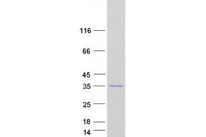 Validation with Western Blot