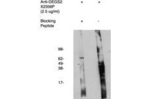 Image no. 1 for anti-Degenerative Spermatocyte Homolog 2, Lipid Desaturase (DEGS2) antibody (ABIN793718) (DEGS2 anticorps)