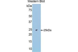 Detection of Recombinant NAGa, Mouse using Polyclonal Antibody to N-Acetylgalactosaminidase Alpha (NAGa)