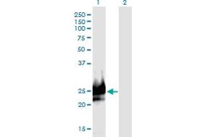 Western Blot analysis of DSCR6 expression in transfected 293T cell line by DSCR6 monoclonal antibody (M09), clone 1D1. (RIPPLY3 anticorps  (AA 1-190))
