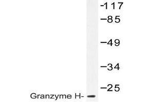 Western blot (WB) analysis of Granzyme H antibody in extracts from K562 cells.