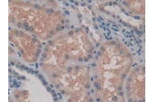 Detection of PRSS1 in Human Kidney Tissue using Polyclonal Antibody to Protease, Serine 1 (PRSS1) (PRSS1 anticorps  (AA 51-228))