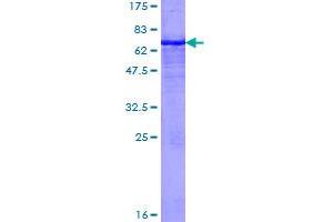Image no. 1 for MHC Class I Polypeptide-Related Sequence A (MICA) (AA 1-383) protein (GST tag) (ABIN1310907)