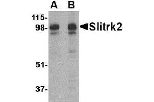 Western blot analysis of Slitrk2 in rat brain tissue lysate with Slitrk2 antibody at (A) 1 and (B) 2 µg/ml.
