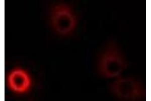 Immunofluorescent analysis of DAO staining in MCF7 cells.