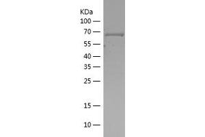Western Blotting (WB) image for Casein Kinase 2 alpha 1 (CSNK2A1) (AA 6-344) protein (His-IF2DI Tag) (ABIN7122158)