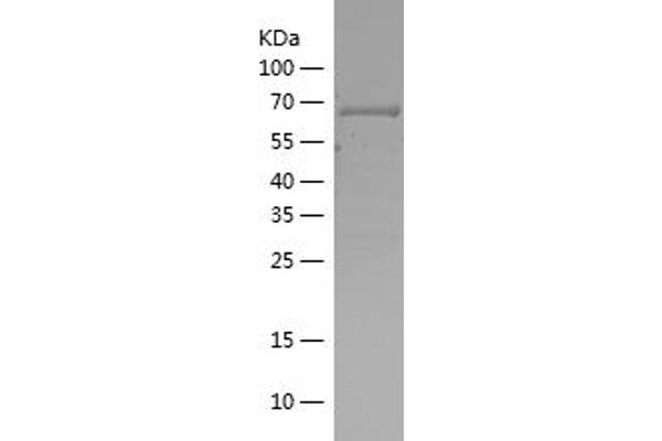 CSNK2A1/CK II alpha Protein (AA 6-344) (His-IF2DI Tag)