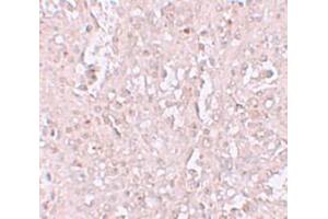 Immunohistochemistry (IHC) image for anti-Solute Carrier Family 39 (Zinc Transporter), Member 13 (SLC39A13) (N-Term) antibody (ABIN1031681) (SLC39A13 anticorps  (N-Term))