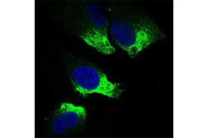 Immunofluorescence analysis of Hela cells using TWIST1 antibody (green).
